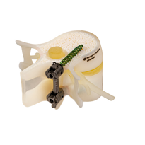 BoneMatrix  DAP 3d printed spine