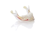 Jaw model using MED620, VeroDent PureWhite, and Vero Vivid Magenta​