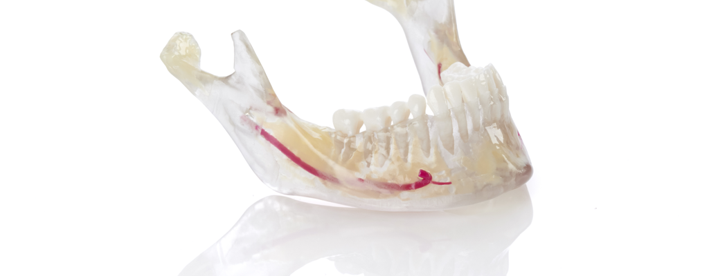 Jaw model using MED620, VeroDent PureWhite, and Vero Vivid Magenta​