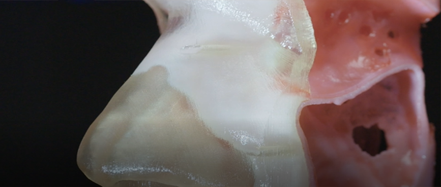 Flattening the learning curve: why 3D printing is a game-changer for surgical training.